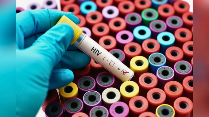 Los recortes a la ayuda estadounidense detienen la investigación de la vacuna contra el VIH en Sudáfrica y amenazan los esfuerzos mundiales para erradicar el VIH. Los recortes a la ayuda estadounidense detienen la investigación de la vacuna contra el VIH en Sudáfrica y amenazan los esfuerzos mundiales para erradicar el VIH.