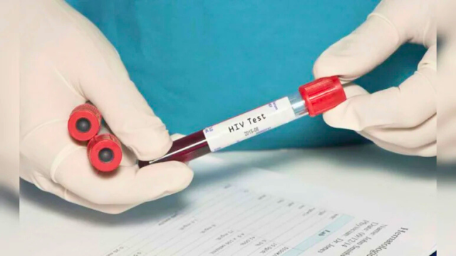 Los recortes de la ayuda estadounidense afectan la investigación de la vacuna contra el VIH en Sudáfrica y los esfuerzos mundiales para erradicar el VIH.