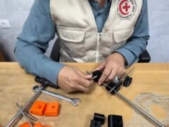 Médicos de Gaza utilizan tecnología 3 D para salvar de la amputación miembros destrozados por Israel