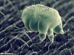 Los funcionarios de salud pública emiten una alerta stake el rápido aumento de los casos de sarna: un paciente advierte: “Fue un infierno … No se lo desearía ni a mi peor enemigo”.