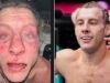 Paddy Pimblett muestra sus lesiones tras la harsh derrota de Justin Gaethje