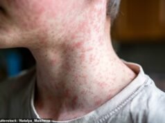 Alerta de salud urgente ya que las autoridades admiten que un virus altamente contagioso ESTÁ CIRCULANDO en Sydney