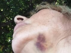 La arrastraron de los pelos en medio de un feroz robo