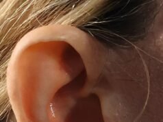 Cómo tus OÍDOS siempre revelan tu edad real. Entonces, ¿ puedes adivinar qué celebridades boy traicionadas por sus lóbulos?