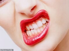 Rechinar los dientes durante la noche afecta a millones de characters, pero a menudo se diagnostica erróneamente o se ignora. Ahora los expertos dicen que hay una señal clave de lo que te está sucediendo … y esto es lo que debes hacer al respecto